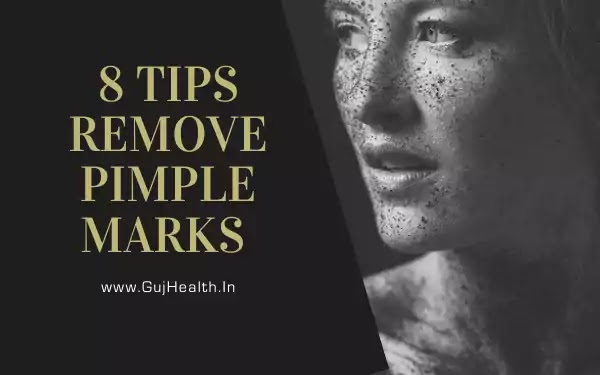 8 Tips Remove Pimple Marks